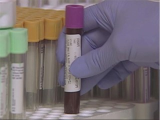 New Medication for High Cholesterol Not Cost-Effective