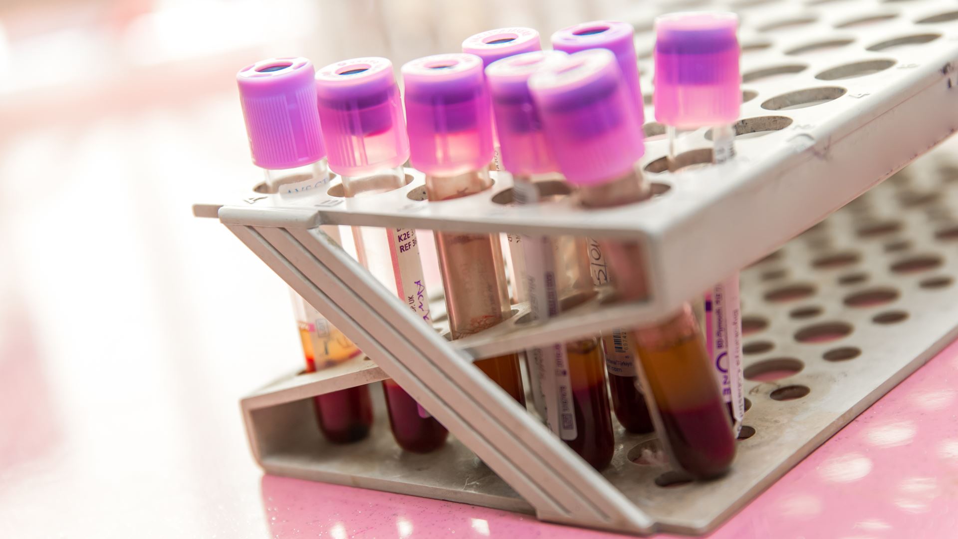 Blood Test Tubes Getty Stock Image