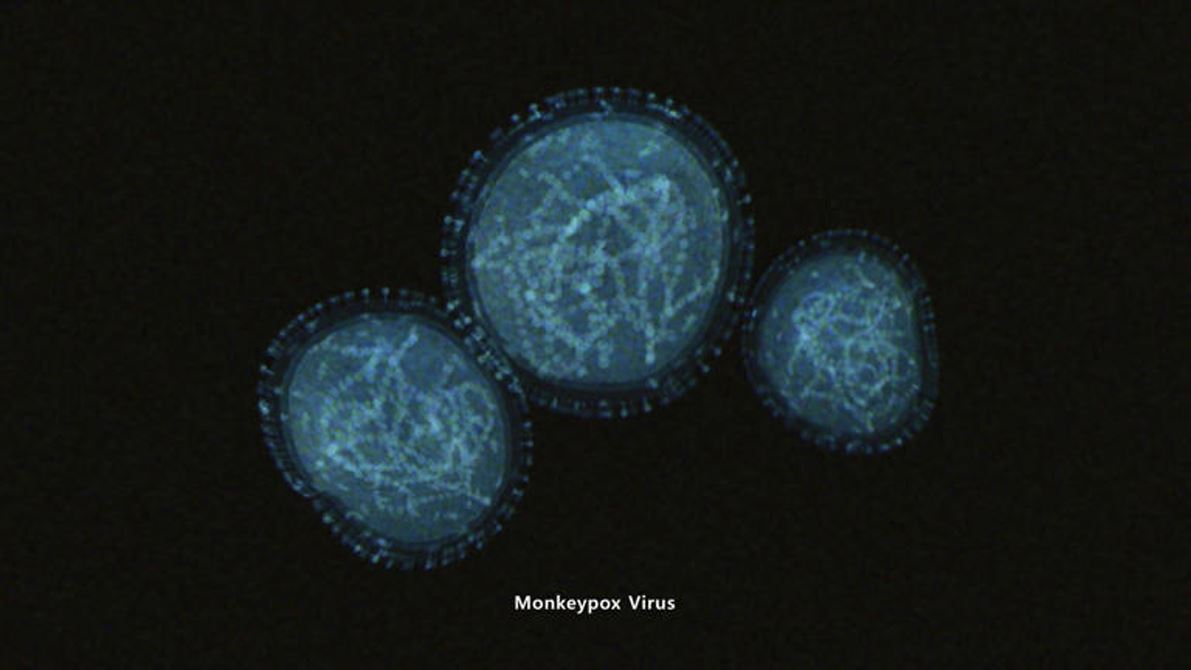 Monkeypox virus