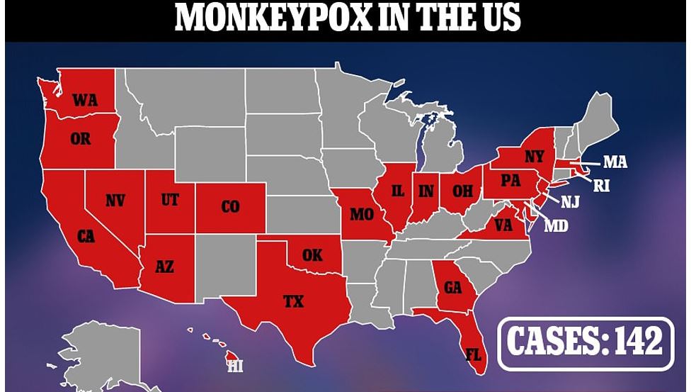 Could monkeypox be the next West Nile Virus?