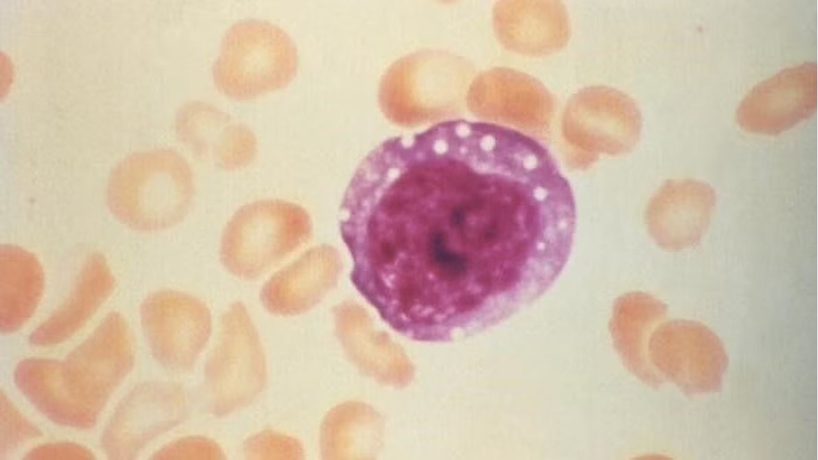 When it comes to COVID-19 immunity, antibodies do not tell the whole story, according to Cedars-Sinai professor