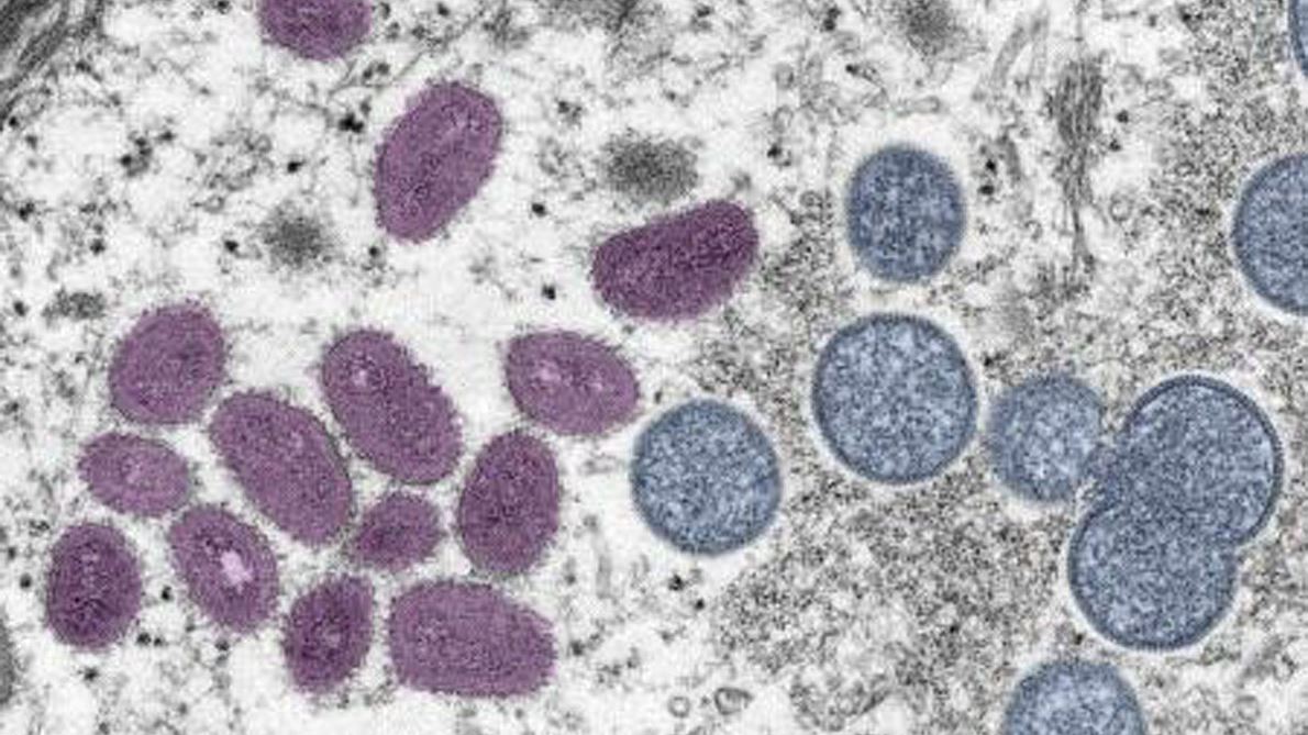 Georgia ranks 3rd nationwide in per capita monkeypox cases. Atlanta is a hotspot