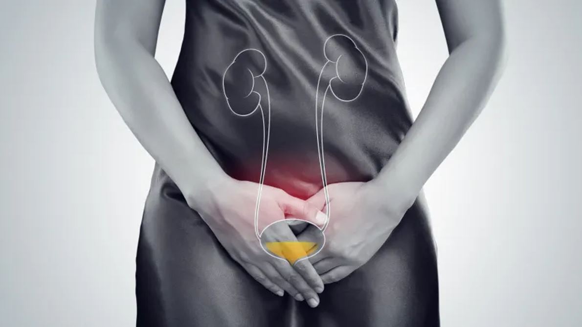 How bladder cancer differs in women and younger adults