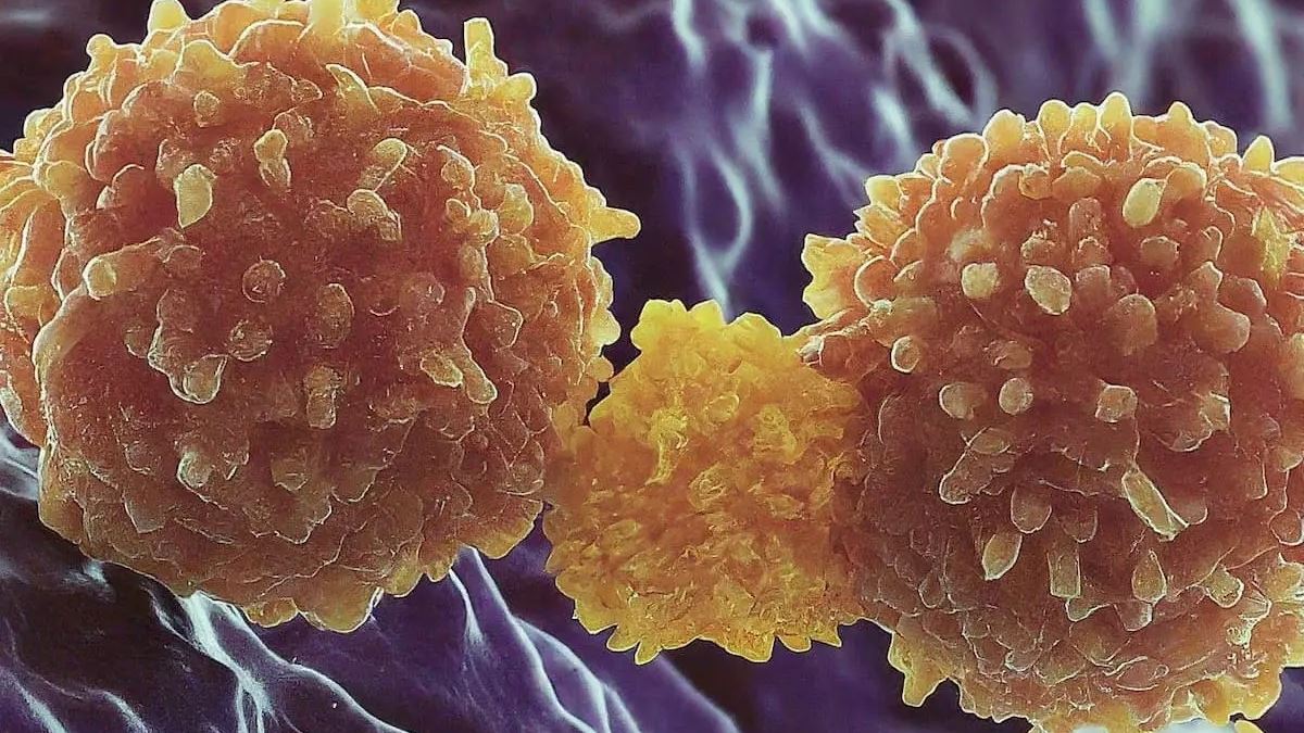 Pathologists Anticipate Evolving Role Using Allogeneic Cell Therapies
