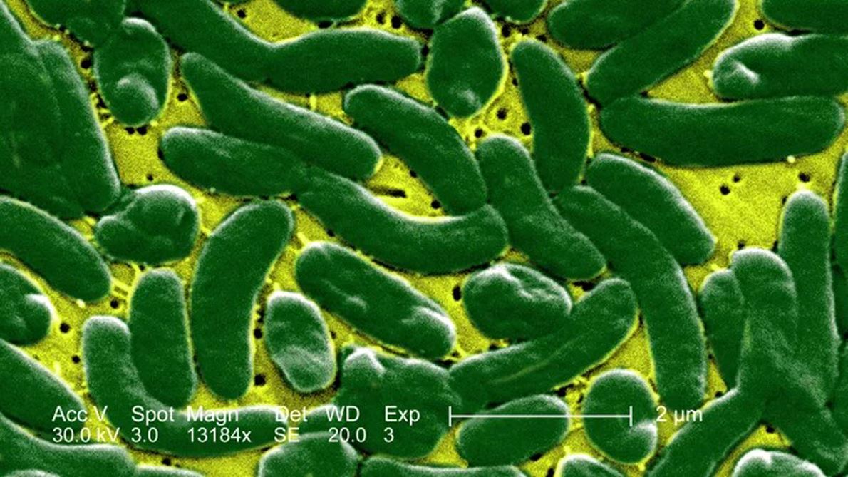 Flesh Eating Bacteria Have Killed 4 People In Florida Here s How They re Spreading