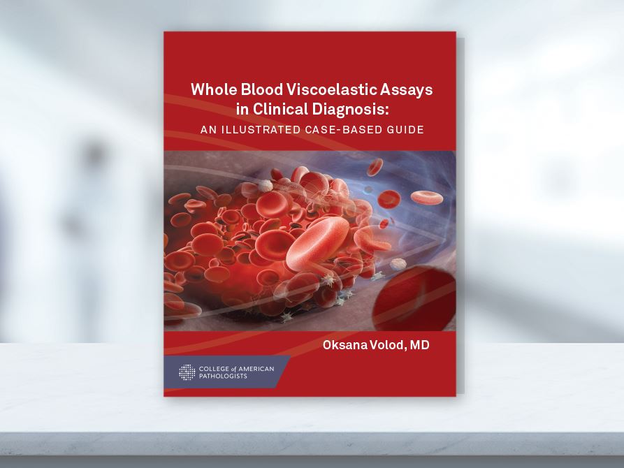 CAP Press Releases New Guide to Whole Blood Viscoelastic Assays