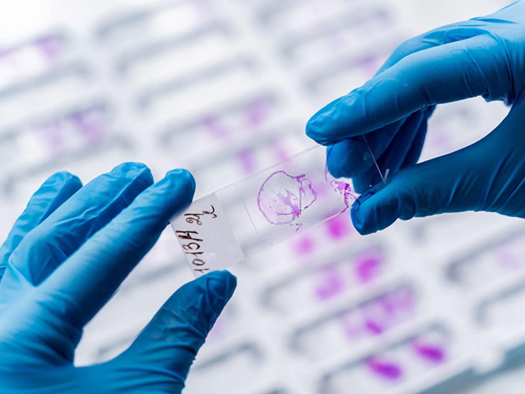 Advanced Spatial Tools Map Hematopoietic Stem Cell Niches
