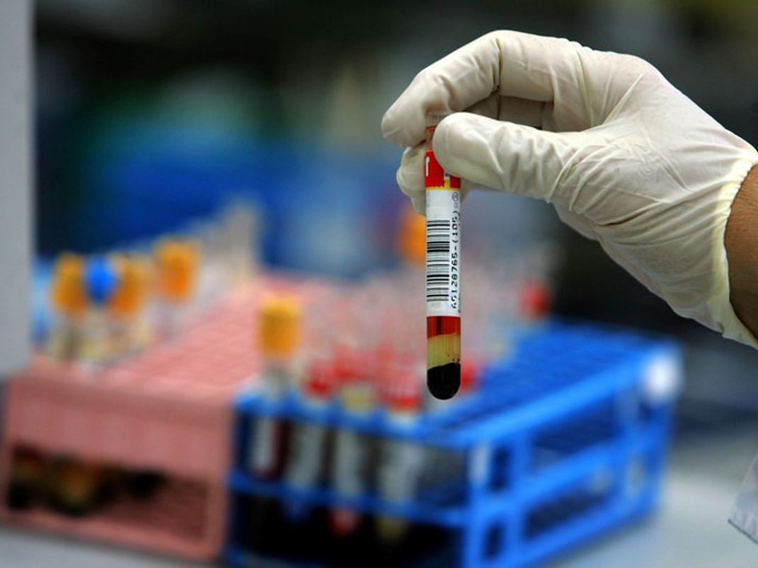 Waiting on OIRA for final LDT rule