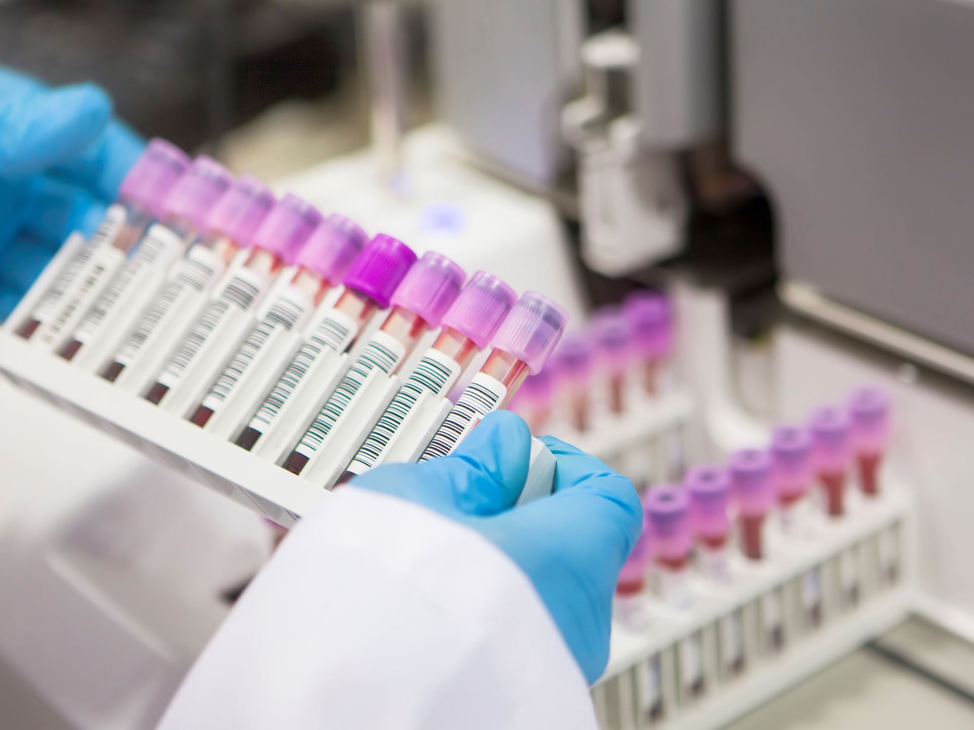 A Joint Position Statement of the American Society of Clinical Oncology ASCO and College of American Pathologists