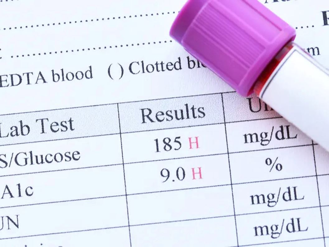 What Is the A1C Test for Diabetes