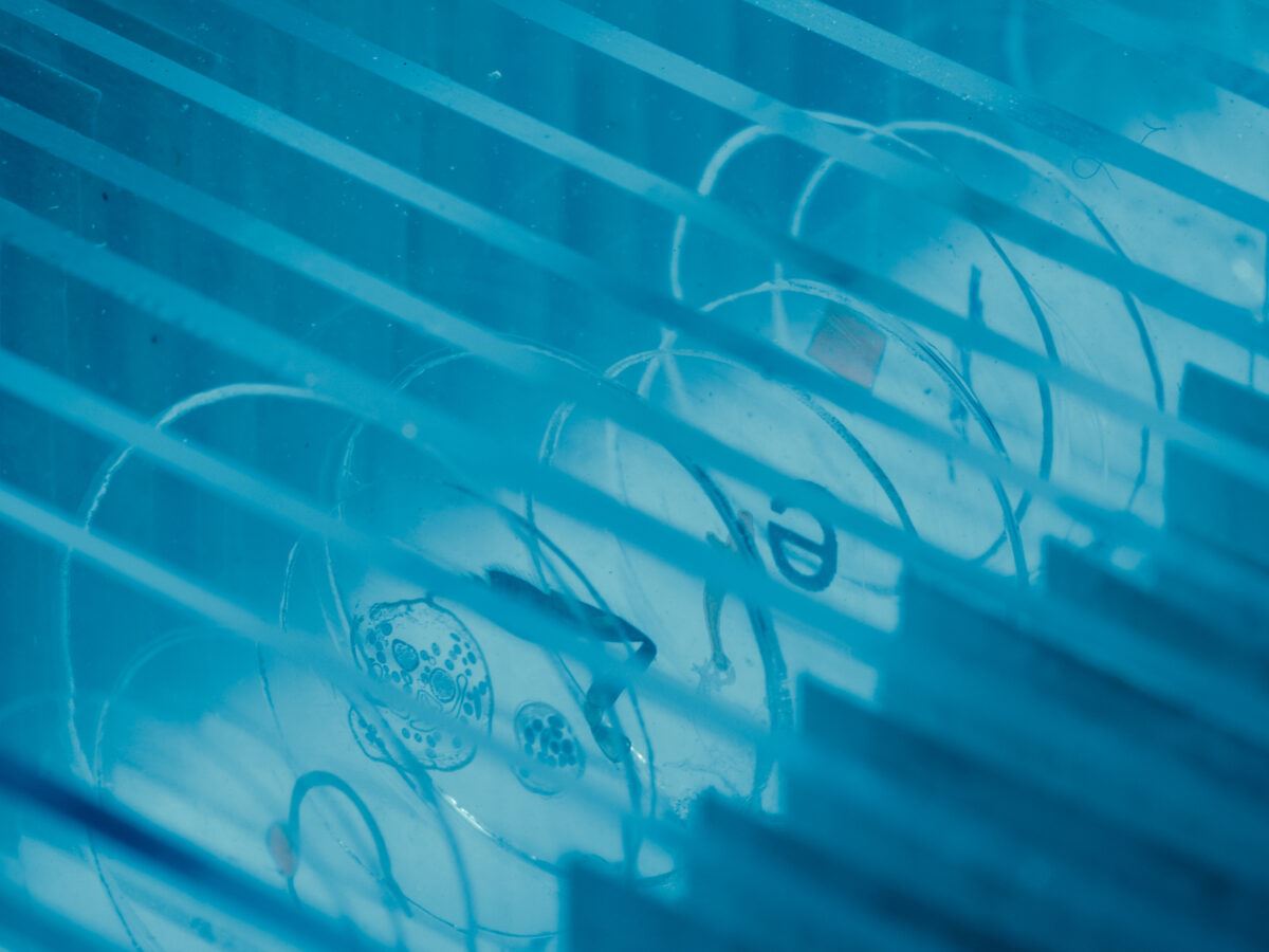 New AI for biopsies can analyze microscopy images talk to pathologists about your tumor