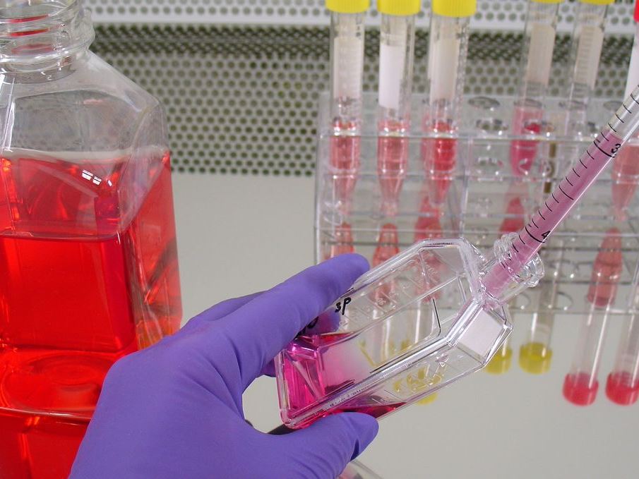 Immunotherapy to treat cancer gave rise to 2nd cancer in extremely rare case