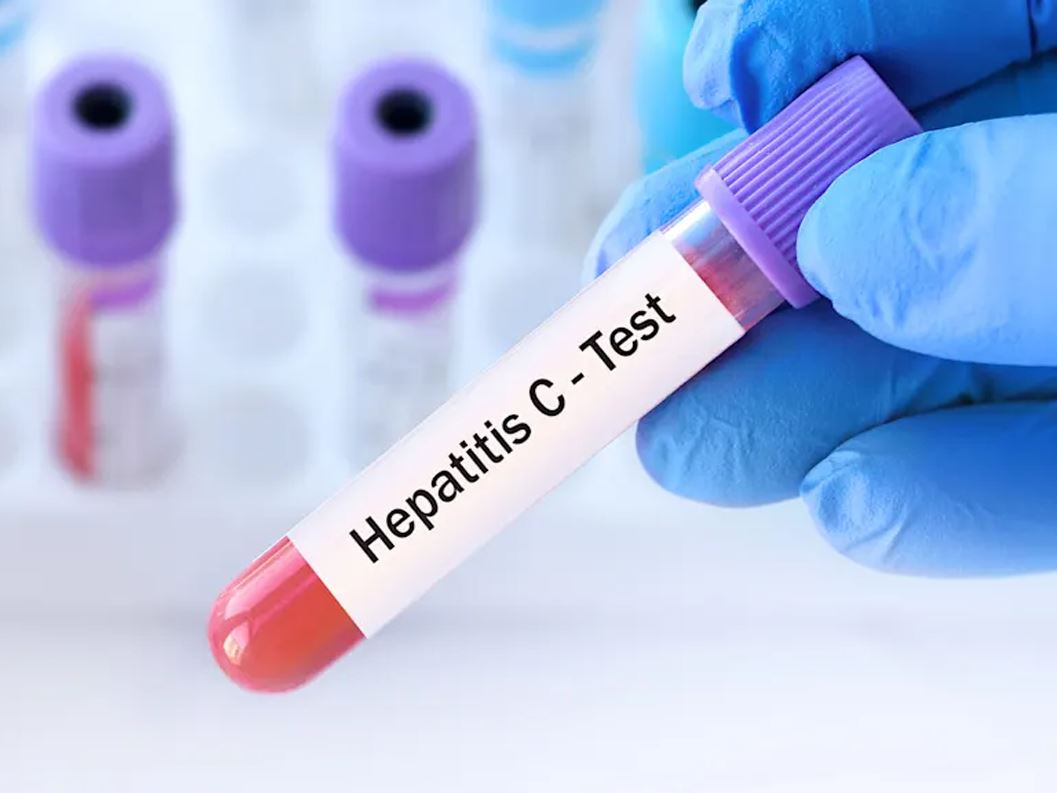 Everything You Need to Know About Hepatitis C Genotypes