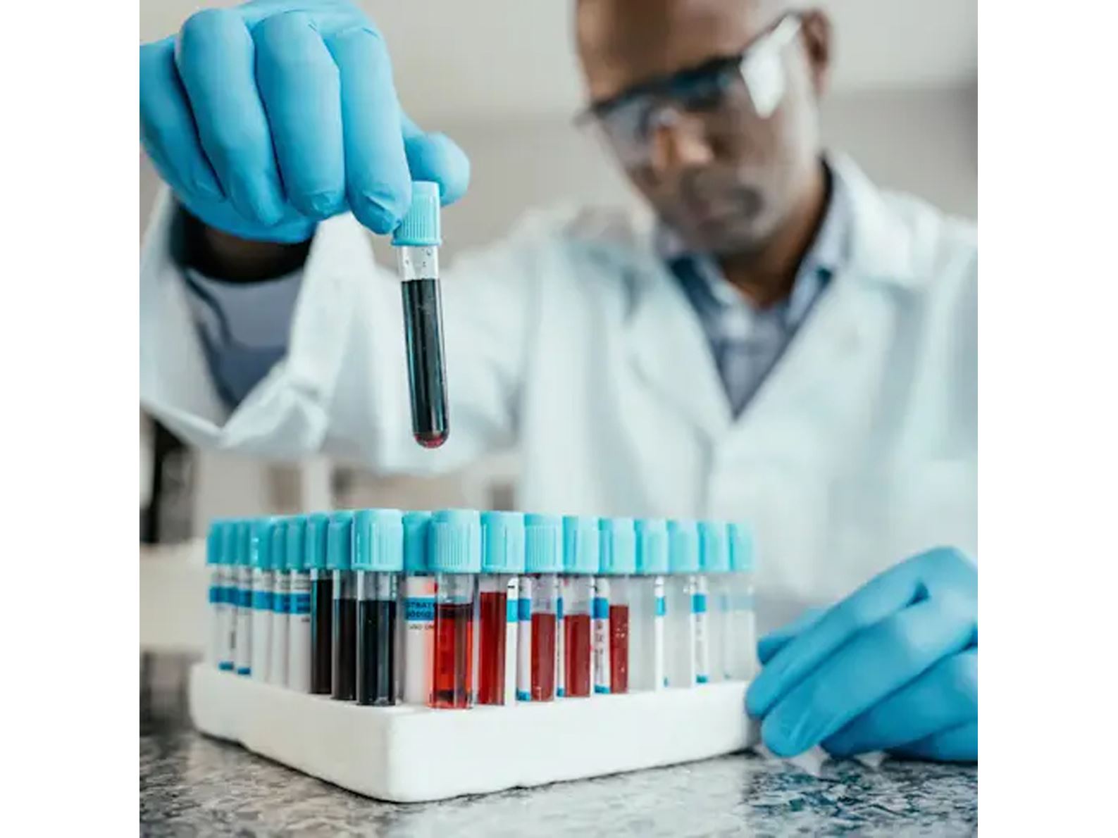 What to Ask Your Doctor About Breast Cancer Biomarker Testing