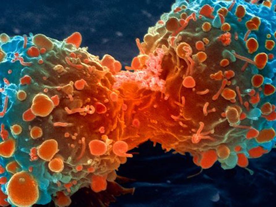 CAP Updates Cancer Protocols