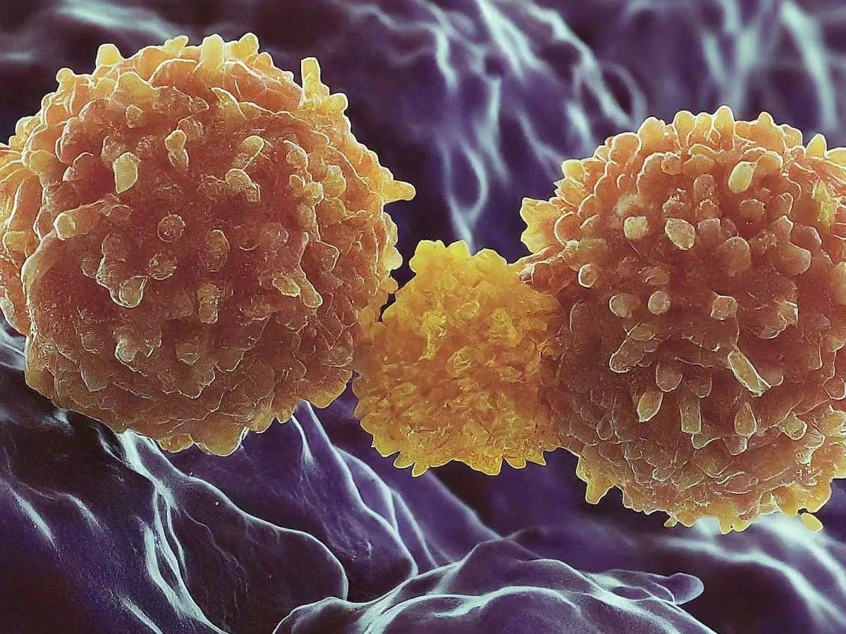 Pathologists Anticipate Evolving Role Using Allogeneic Cell Therapies