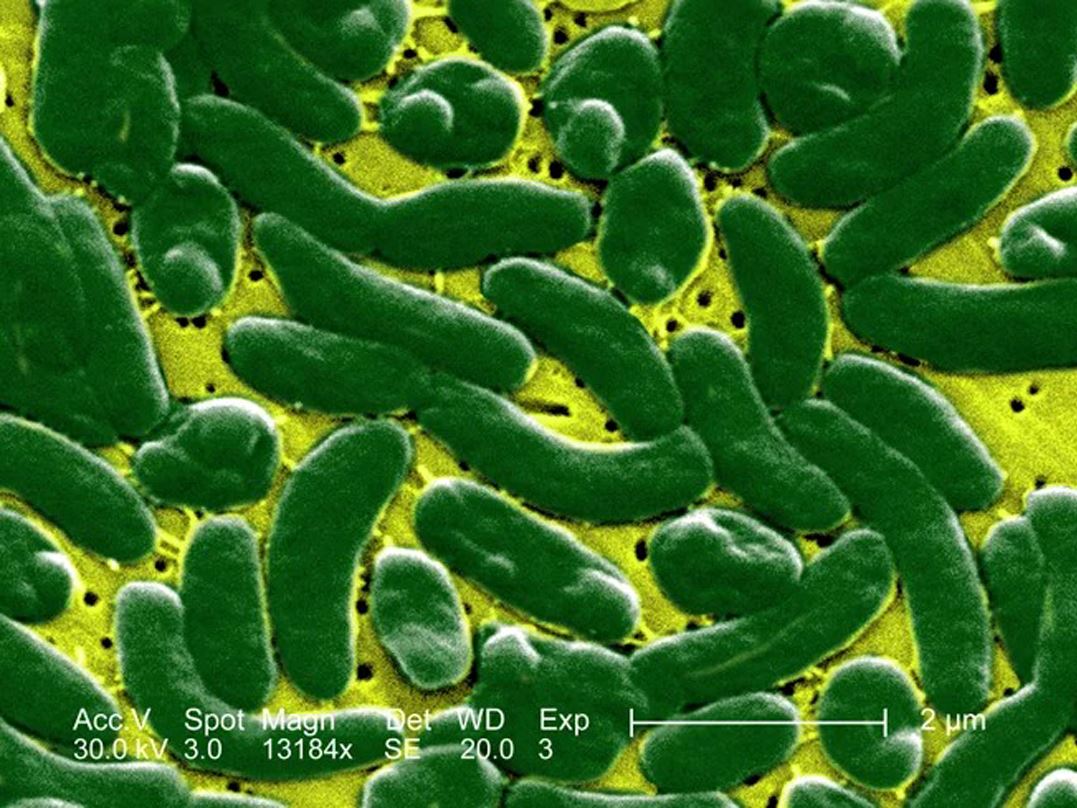 Flesh Eating Bacteria Have Killed 4 People In Florida Here s How They re Spreading