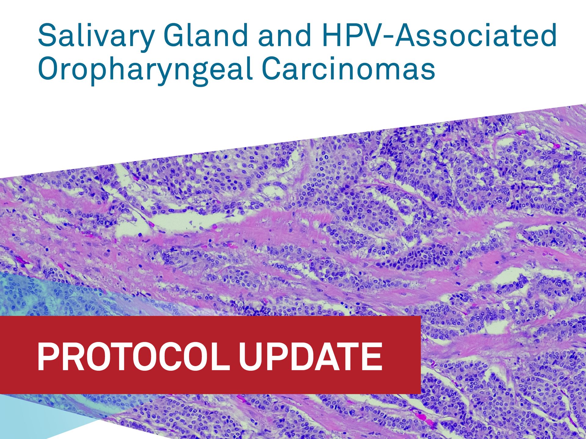 CAP statement on Salivary Gland and HPV Associated Oropharyngeal Carcinomas
