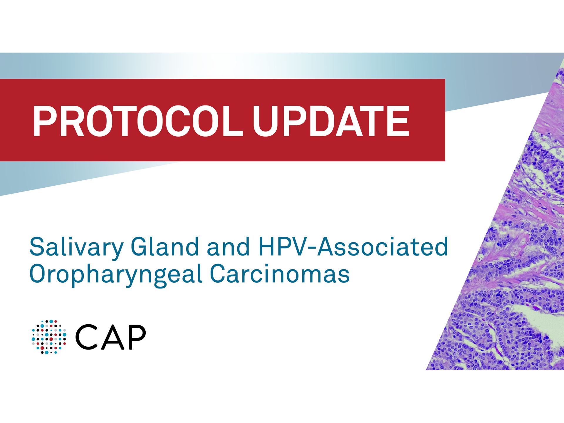CAP statement on Salivary Gland and HPV Associated Oropharyngeal Carcinomas