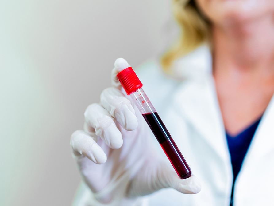Blood test uses donor DNA to track transplant health