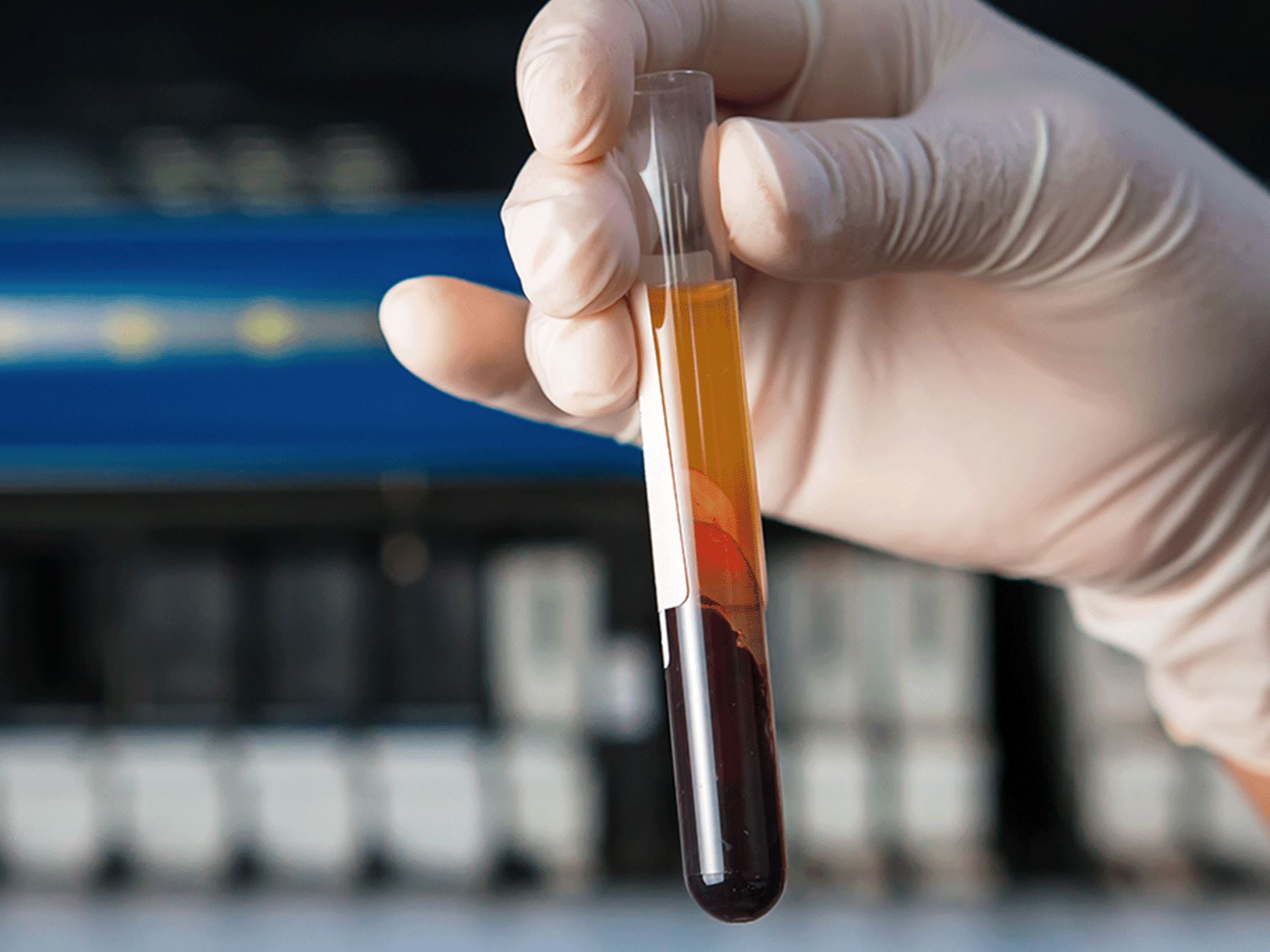 Cell Free DNA in Pathology
