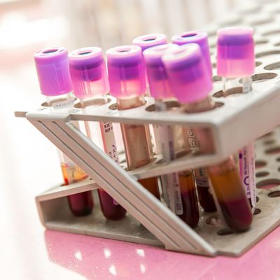 Blood Test Tubes Getty Stock Image