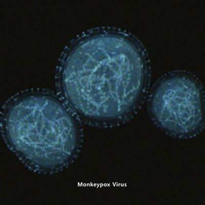 Monkeypox virus