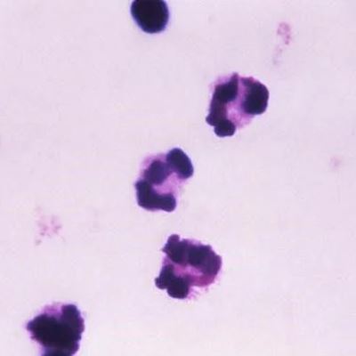 COVID-19 Immunity Test Inventor: ‘It’s Not Just About Antibodies’ (CDC PHIL)