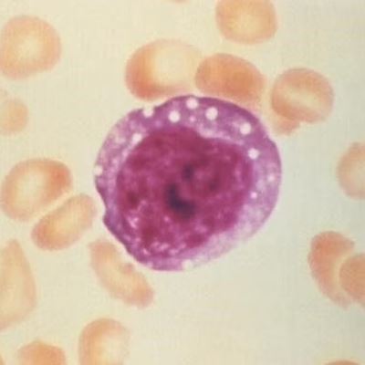 When it comes to COVID-19 immunity, antibodies do not tell the whole story, according to Cedars-Sinai professor