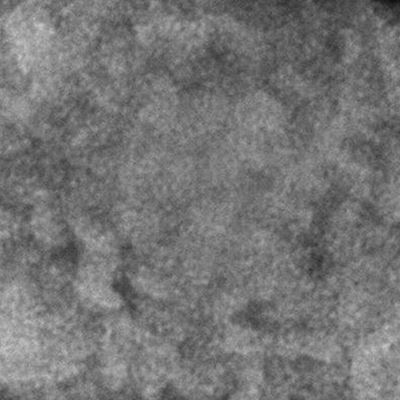 Are monkeypox scars permanent? – USA News Hub