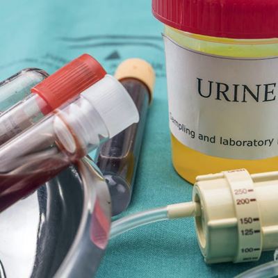 Urine-PCR
