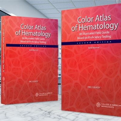 Color Atlas of Hematology