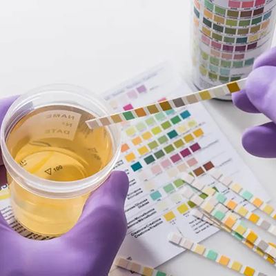 Will CBD Cause Me to Fail a Drug Test