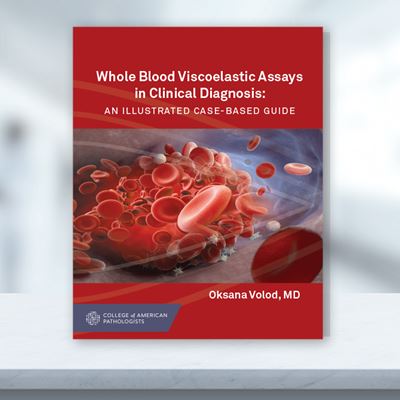 CAP Press Releases New Guide to Whole Blood Viscoelastic Assays