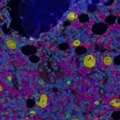 Contents of Human Bone Marrow Mapped