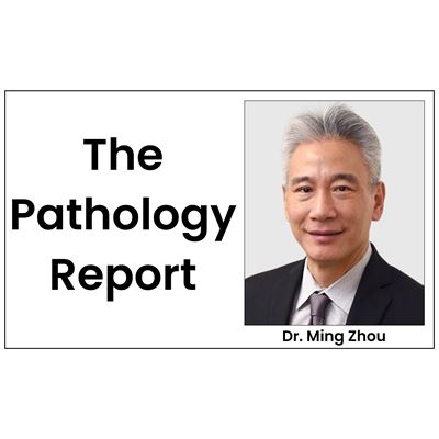 You got questions Pathologist Zhou has answers