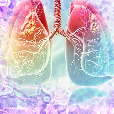 CAP Publishes Guideline for PD L1 Testing of Patients with Lung Cancer