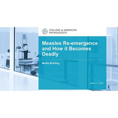 Measles Re emergence and How it Becomes Deadly