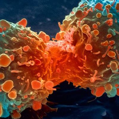 CAP Updates Cancer Protocols