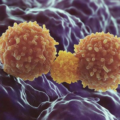 Pathologists Anticipate Evolving Role Using Allogeneic Cell Therapies