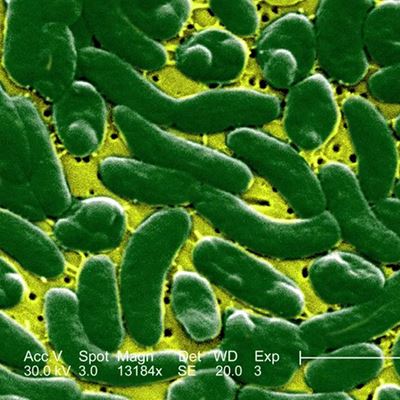 Flesh Eating Bacteria Have Killed 4 People In Florida Here s How They re Spreading