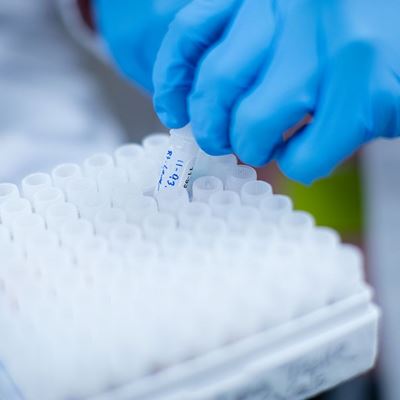 Cedars-Sinai Biobank Earns Rare Global Accreditation