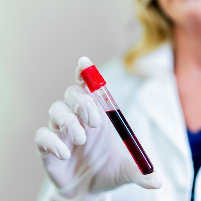 Blood test uses donor DNA to track transplant health