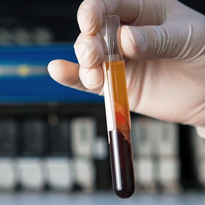 Cell Free DNA in Pathology