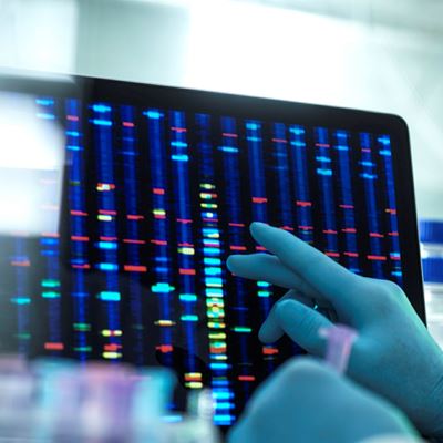 Donor Derived Cell Free DNA May Aid Monitoring of Kidney Transplant Recipients