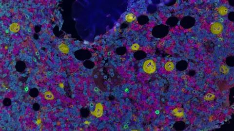 Contents of Human Bone Marrow Mapped