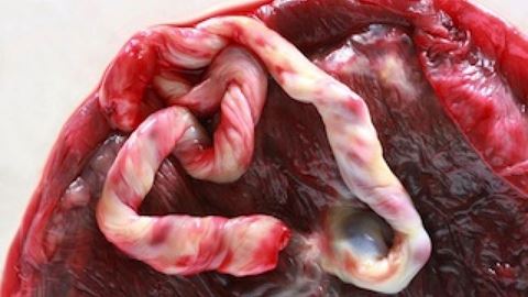 Should You Eat Your Placenta? Plus Other Things You Should Know About This Fascinating Organ