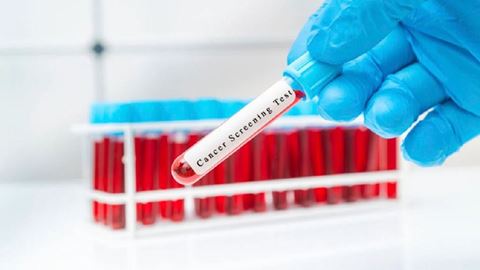 FDA approves blood-based test for colorectal cancer as expert says it could help early detection