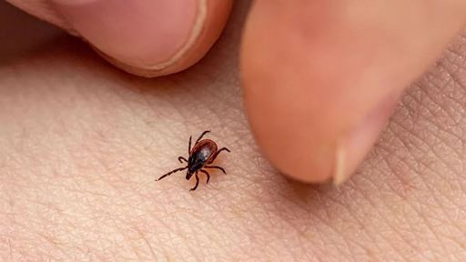 Lyme Disease How to Prevent It and What to Do if a Tick Bites You