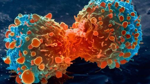 CAP Updates Cancer Protocols